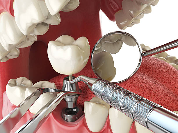 Best Emergency Treatment for Oral Infections in East Rancho Dominguez, CA